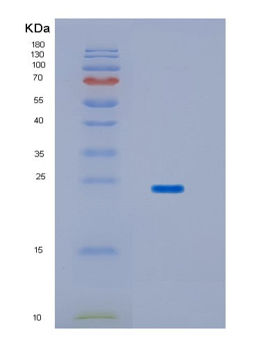 SDS-PAGE analysis of Human HPCAL1 (Hippocalcin-Like Protein 1) - Recombinant Protein, showing >85% purity under 15% SDS-PAGE (Reduced)
