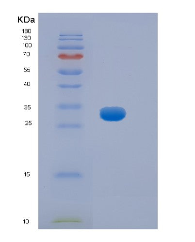 SDS-PAGE analysis of Mouse Hpgd (15-Hydroxyprostaglandin Dehydrogenase [Nad(+)]) - Recombinant Protein, showing >85% purity under 15% SDS-PAGE (Reduced)