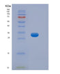 SDS-PAGE analysis of Mouse Hpgd (15-Hydroxyprostaglandin Dehydrogenase [Nad(+)]) - Recombinant Protein, showing >85% purity under 15% SDS-PAGE (Reduced)