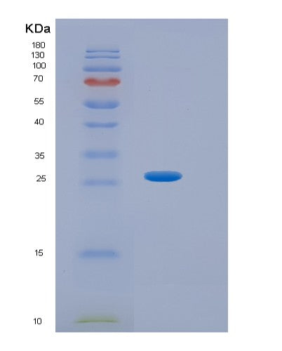 SDS-PAGE analysis of Human HPRT1 (Hypoxanthine-Guanine Phosphoribosyltransferase) - Recombinant Protein, showing >85% purity under 15% SDS-PAGE (Reduced)