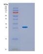 SDS-PAGE analysis of Human HPRT1 (Hypoxanthine-Guanine Phosphoribosyltransferase) - Recombinant Protein, showing >85% purity under 15% SDS-PAGE (Reduced)