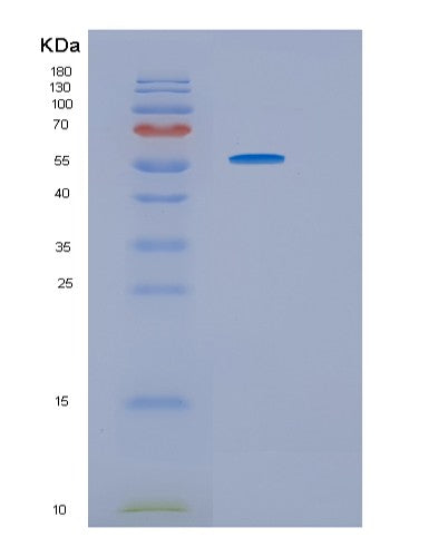 SDS-PAGE analysis of Human HRS (Histidyl-tRNA synthetase) - Recombinant Protein, CAT# BLT-08380P showing >85% purity under 15% SDS-PAGE (Reduced)
