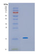SDS-PAGE analysis of Human RIDA (2-Iminobutanoate/2-Iminopropanoate Deaminase) - Recombinant Protein, showing >95% purity under 15% SDS-PAGE (Reduced)