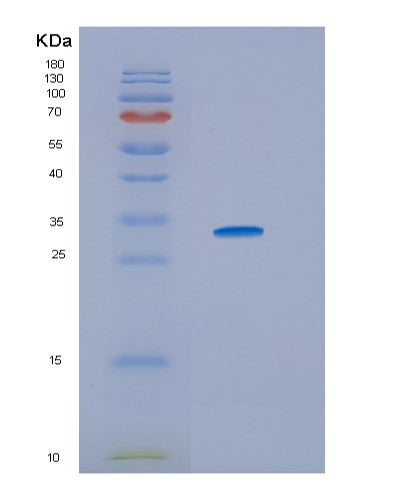 SDS-PAGE analysis of Human HSD17B10 (3-Hydroxyacyl-Coa Dehydrogenase Type-2) - Recombinant Protein, showing >90% purity under 15% SDS-PAGE (Reduced)