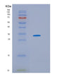 SDS-PAGE analysis of Human HSD17B10 (3-Hydroxyacyl-Coa Dehydrogenase Type-2) - Recombinant Protein, showing >90% purity under 15% SDS-PAGE (Reduced)