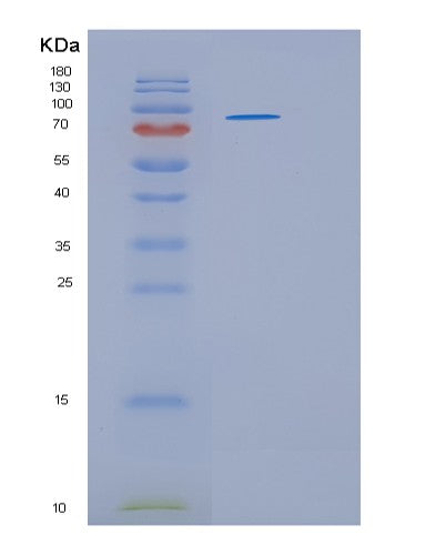 SDS-PAGE analysis of Human HSP90B1 (Endoplasmin) - Recombinant Protein, showing >90% purity under 15% SDS-PAGE (Reduced)