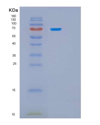 SDS-PAGE analysis of Human HSPA5 (Endoplasmic Reticulum Chaperone Bip) - Recombinant Protein, showing >95% purity under 15% SDS-PAGE (Reduced)