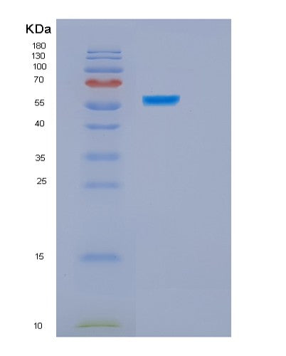 SDS-PAGE analysis of Human HSPBAP1 (Hspb1-Associated Protein 1) - Recombinant Protein, showing >95% purity under 15% SDS-PAGE (Reduced)