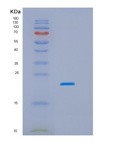 SDS-PAGE analysis of Human LGALSL (Galectin-Related Protein) - Recombinant Protein, showing >85% purity under 15% SDS-PAGE (Reduced)