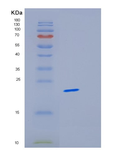 SDS-PAGE analysis of Human MRPL58 (Large Ribosomal Subunit Protein Ml62) - Recombinant Protein, showing >85% purity under 15% SDS-PAGE (Reduced)