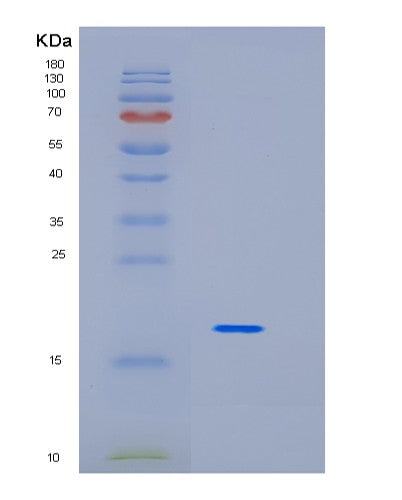 SDS-PAGE analysis of Human ID1 (Dna-Binding Protein Inhibitor Id-1) - Recombinant Protein, showing >95% purity under 15% SDS-PAGE (Reduced)