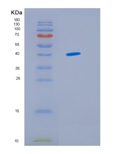 SDS-PAGE analysis of Human IDH3G (Isocitrate Dehydrogenase [Nad] Subunit Gamma, Mitochondrial) - Recombinant Protein, showing >95% purity under 15% SDS-PAGE (Reduced)