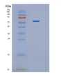 SDS-PAGE analysis of Human IDS (Iduronate 2-Sulfatase) - Recombinant Protein, showing >85% purity under 15% SDS-PAGE (Reduced)