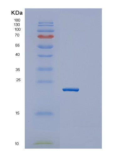 SDS-PAGE analysis of Mouse Igfbp6 (Insulin-Like Growth Factor-Binding Protein 6) - Recombinant Protein, showing >90% purity under 15% SDS-PAGE (Reduced)