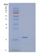 SDS-PAGE analysis of Human JCHAIN (Immunoglobulin J Chain) - Recombinant Protein, showing >85% purity under 15% SDS-PAGE (Reduced)