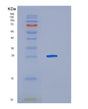SDS-PAGE analysis of Human IL10RA (Interleukin-10 Receptor Subunit Alpha) - Recombinant Protein, showing >95% purity under 15% SDS-PAGE (Reduced)
