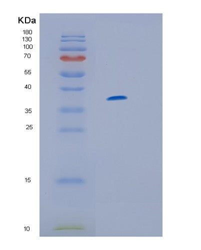 SDS-PAGE analysis of Human IL13RA1 (Interleukin-13 Receptor Subunit Alpha-1) - Recombinant Protein, showing >95% purity under 15% SDS-PAGE (Reduced)