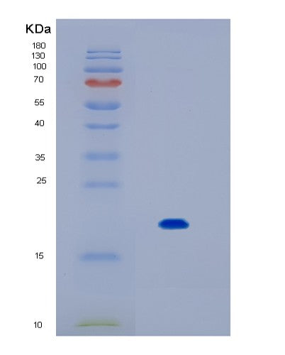 SDS-PAGE analysis of Human IL17B (Interleukin-17B) - Recombinant Protein, showing >90% purity under 15% SDS-PAGE (Reduced)