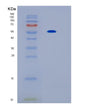 SDS-PAGE analysis of Mouse Il17rb (Interleukin-17 Receptor B) - Recombinant Protein, showing >85% purity under 15% SDS-PAGE (Reduced)