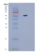 SDS-PAGE analysis of Human IL17RB (Interleukin-17 Receptor B) - Recombinant Protein, showing >95% purity under 15% SDS-PAGE (Reduced)