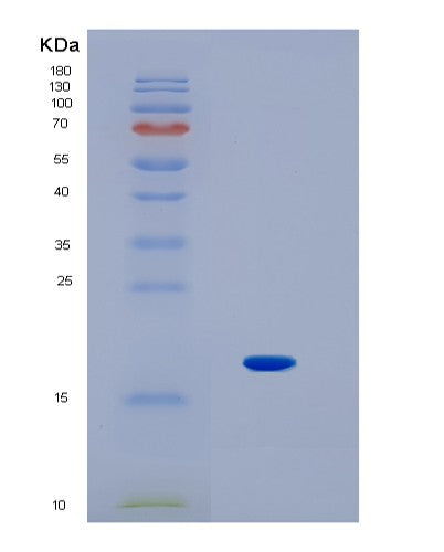 SDS-PAGE analysis of Human IL1F10 (Interleukin-1 Family Member 10) - Recombinant Protein, showing >90% purity under 15% SDS-PAGE (Reduced)