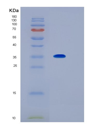 SDS-PAGE analysis of Human IL1RL1 (Interleukin-1 Receptor-Like 1) - Recombinant Protein, showing >85% purity under 15% SDS-PAGE (Reduced)