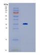 SDS-PAGE analysis of Human IL1RL1 (Interleukin-1 Receptor-Like 1) - Recombinant Protein, showing >85% purity under 15% SDS-PAGE (Reduced)