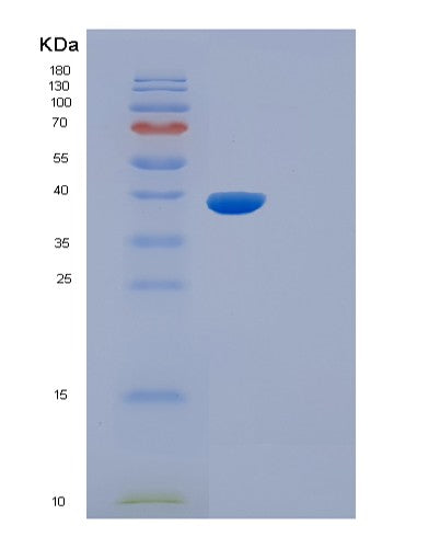SDS-PAGE analysis of Mouse Il5ra (Interleukin-5 Receptor Subunit Alpha) - Recombinant Protein, showing >90% purity under 15% SDS-PAGE (Reduced)