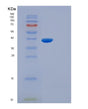 SDS-PAGE analysis of Mouse Il5ra (Interleukin-5 Receptor Subunit Alpha) - Recombinant Protein, showing >90% purity under 15% SDS-PAGE (Reduced)