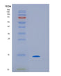 SDS-PAGE analysis of Human IL9 (Interleukin-9) - Recombinant Protein, showing >85% purity under 15% SDS-PAGE (Reduced)