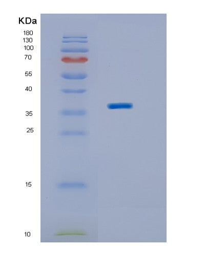 SDS-PAGE analysis of Human BPNT2 (Golgi-Resident Adenosine 3',5'-Bisphosphate 3'-Phosphatase) - Recombinant Protein, showing >90% purity under 15% SDS-PAGE (Reduced)