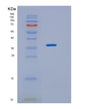 SDS-PAGE analysis of Human BPNT2 (Golgi-Resident Adenosine 3',5'-Bisphosphate 3'-Phosphatase) - Recombinant Protein, showing >90% purity under 15% SDS-PAGE (Reduced)