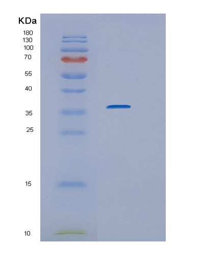 SDS-PAGE analysis of Human IL1R1 (Interleukin-1 Receptor Type 1) - Recombinant Protein, showing >95% purity under 15% SDS-PAGE (Reduced)
