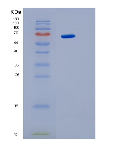SDS-PAGE analysis of Human IL6ST (Interleukin-6 Receptor Subunit Beta) - Recombinant Protein, showing >95% purity under 15% SDS-PAGE (Reduced)