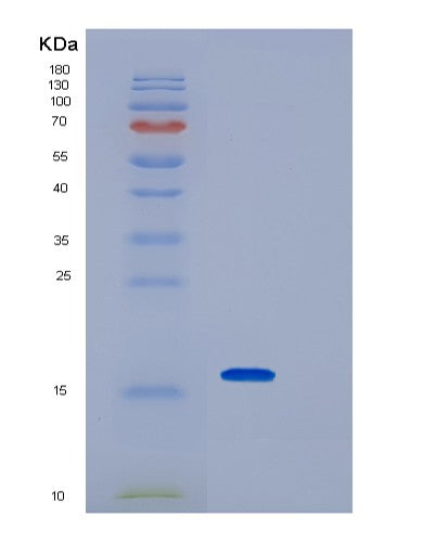 SDS-PAGE analysis of Human IPP (Actin-Binding Protein Ipp) - Recombinant Protein, CAT# BLT-08383P showing >95% purity under 15% SDS-PAGE (Reduced)