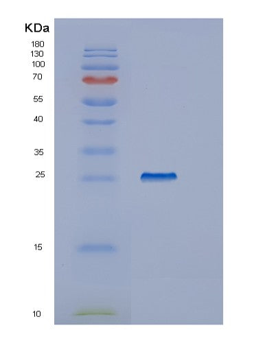 SDS-PAGE analysis of Human IYD (Iodotyrosine Deiodinase 1) - Recombinant Protein, showing >85% purity under 15% SDS-PAGE (Reduced)