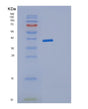 SDS-PAGE analysis of Human JMJD7 (Bifunctional Peptidase And (3S)-Lysyl Hydroxylase Jmjd7) - Recombinant Protein, showing >95% purity under 15% SDS-PAGE (Reduced)
