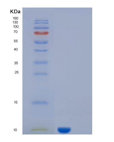 SDS-PAGE analysis of Human KAAG1 (Kidney-Associated Antigen 1) - Recombinant Protein, showing >90% purity under 15% SDS-PAGE (Reduced)