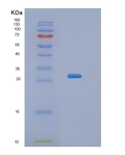 SDS-PAGE analysis of Human KCTD11 (Btb/Poz Domain-Containing Protein Kctd11) - Recombinant Protein, showing >85% purity under 15% SDS-PAGE (Reduced)