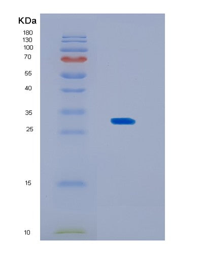 SDS-PAGE analysis of Human KCTD15 (Btb/Poz Domain-Containing Protein Kctd15) - Recombinant Protein, showing >95% purity under 15% SDS-PAGE (Reduced)