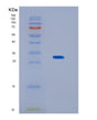 SDS-PAGE analysis of Human KCTD15 (Btb/Poz Domain-Containing Protein Kctd15) - Recombinant Protein, showing >95% purity under 15% SDS-PAGE (Reduced)
