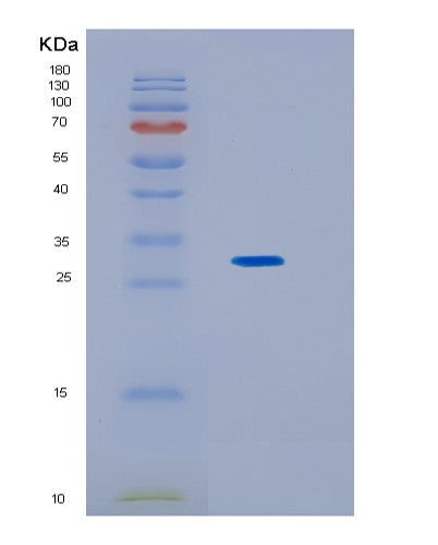 SDS-PAGE analysis of Human KCTD5 (Btb/Poz Domain-Containing Protein Kctd5) - Recombinant Protein, showing >85% purity under 15% SDS-PAGE (Reduced)