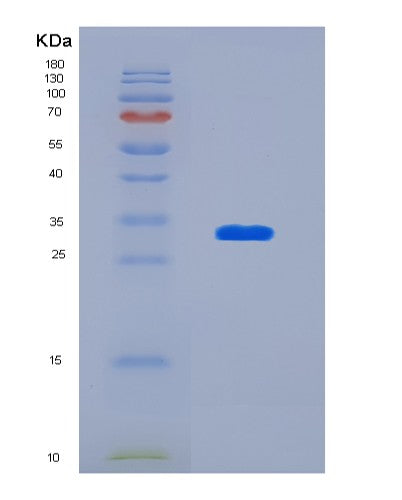 SDS-PAGE analysis of Human KHK (Ketohexokinase) - Recombinant Protein, showing >85% purity under 15% SDS-PAGE (Reduced)