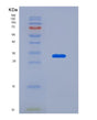 SDS-PAGE analysis of Human KHK (Ketohexokinase) - Recombinant Protein, showing >85% purity under 15% SDS-PAGE (Reduced)