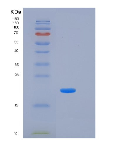 SDS-PAGE analysis of Human KLK7 (Kallikrein-7) - Recombinant Protein, showing >90% purity under 15% SDS-PAGE (Reduced)