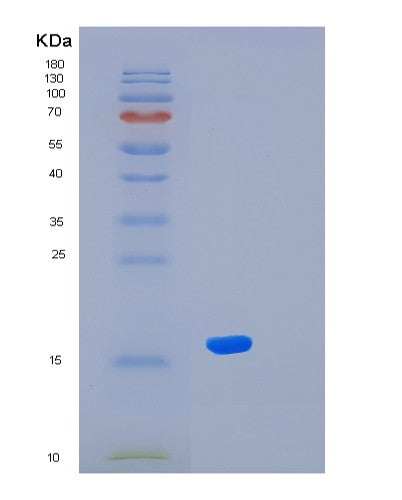 SDS-PAGE analysis of Human KLRG1 (Killer Cell Lectin-Like Receptor Subfamily G Member 1) - Recombinant Protein, showing >95% purity under 15% SDS-PAGE (Reduced)