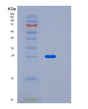 SDS-PAGE analysis of Mouse Ldlr (Low-Density Lipoprotein Receptor) - Recombinant Protein, showing >90% purity under 15% SDS-PAGE (Reduced)