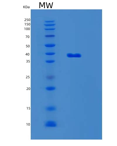 SDS-PAGE analysis of Mouse Lgals8 (Galectin-8) - Recombinant Protein, showing >95% purity under 15% SDS-PAGE (Reduced)
