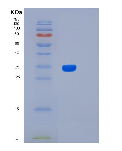 SDS-PAGE analysis of Human BIRC7 (Baculoviral Iap Repeat-Containing Protein 7) - Recombinant Protein, showing >90% purity under 15% SDS-PAGE (Reduced)