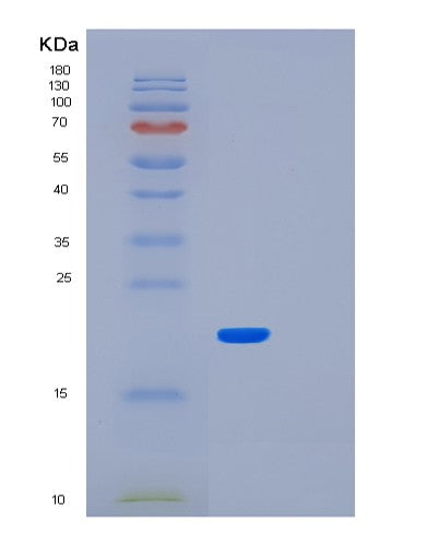 SDS-PAGE analysis of Human LMO1 (Rhombotin-1) - Recombinant Protein, showing >95% purity under 15% SDS-PAGE (Reduced)
